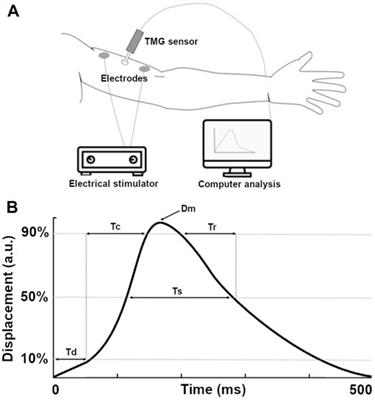 Tensiomyography: from muscle assessment to talent identification tool
